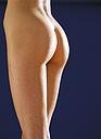 Gluteos Cirugia plastica Cirugia estetica