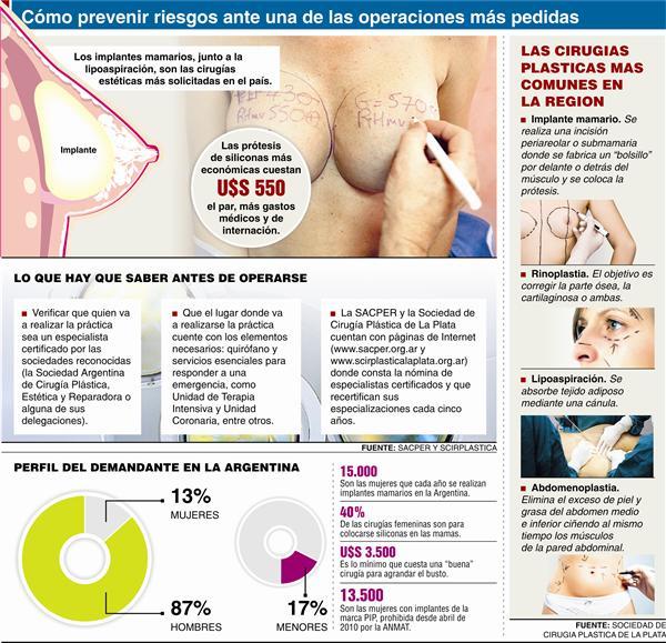 Implantes mamarios  